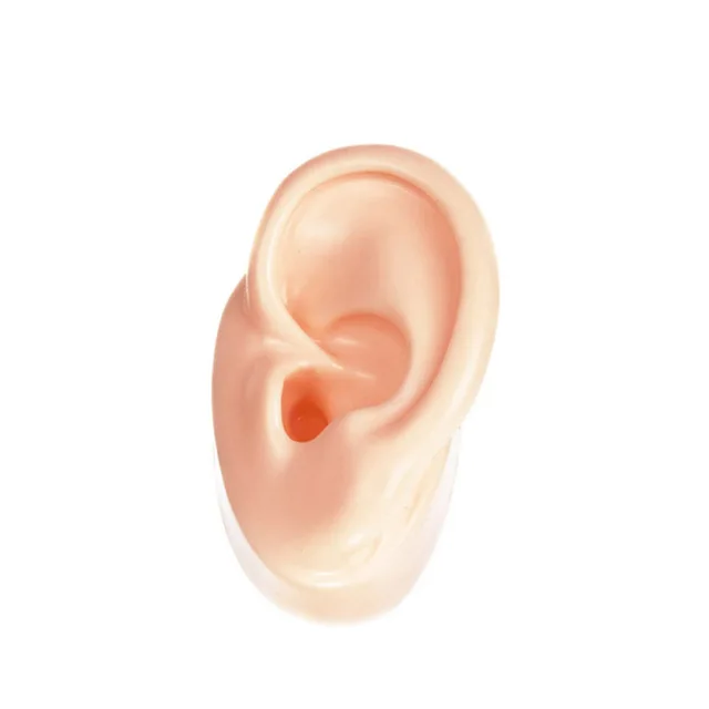 homeopathic remedy for tinnitus